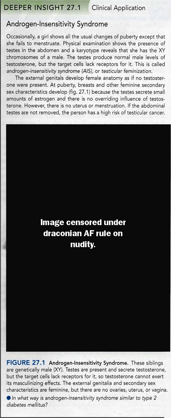 [Image: androgen-insensitivity-syndrome-scanned-censored.jpg]